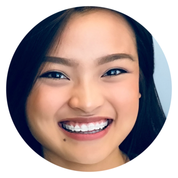 Girl with clear braces