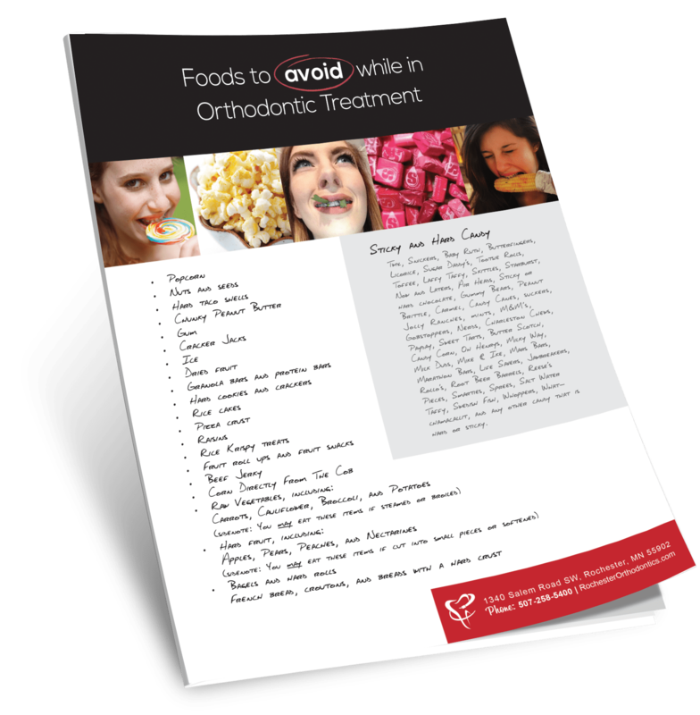 Foods to avoid while in orthodontic treatment guide